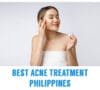 Best Acne Treatment Philippines 2022