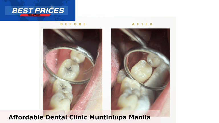 Clinique Dentaire - Dental Clinic Muntinlupa Manila, Affordable Dental Clinic Muntinlupa Manila, affordable dental clinic near me, dental clinic in putatan muntinlupa, dental clinic near me open now, dental clinic in bayanan muntinlupa, dental clinic tunasan muntinlupa, dentist near me, dental clinic in festival mall alabang, dental clinic alabang, dental clinic open now, Can tooth pain be an emergency?, Can I go A&E for toothache Philippines?, 24 Hour Dentists Philippines, Dentist open now,