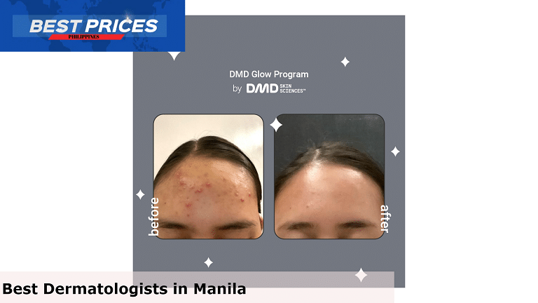 DMD Skin Sciences - Dermatologist Manila, Dermatologist Manila, How much does it cost to see a dermatologist in Philippines?, Dermatology doctors in Manila, When should I consult a dermatologist?, Is dermatologist good for skin?, Is there a dermatology course in the Philippines?, Best 10 Dermatologists in Manila, affordable dermatologist in manila, best dermatologist manila, dermatologist near me, dermatologist near me with free consultation, best affordable dermatologist near me, dermatologist near me walk-in, manila doctors dermatologist schedule, dermatologist in sm manila,