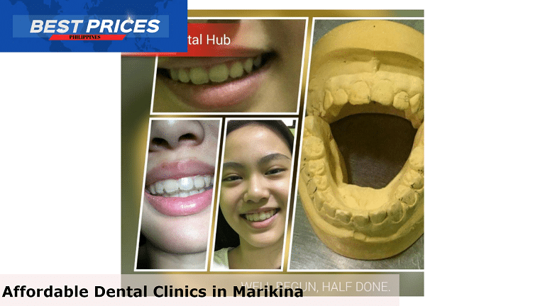 MD 14 Dental Hub - Affordable Dental Clinic Marikina, Affordable Dental Clinic Marikina, Best Dental Care Clinics Marikina City, Dentists in Marikina City Philippines, dental clinic in marikina open today, best dental clinic in marikina, dental clinic in marikina accredited by intellicare, dental clinic concepcion marikina, dental clinic near me, dental clinic ayala mall marikina, dental clinic near me with price, free dental services marikina, Emergency Dental Treatment, Which doctor is best for teeth?, How do I choose a dentist in Philippines?, How do I choose a dental practice?, dental clinic marikina bayan, dental clinic in marikina open today,