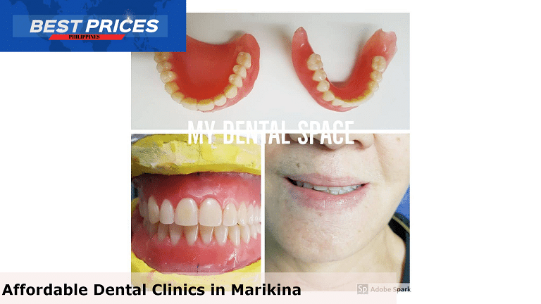 My Dental Space - Affordable Dental Clinic Marikina, Affordable Dental Clinic Marikina, Best Dental Care Clinics Marikina City, Dentists in Marikina City Philippines, dental clinic in marikina open today, best dental clinic in marikina, dental clinic in marikina accredited by intellicare, dental clinic concepcion marikina, dental clinic near me, dental clinic ayala mall marikina, dental clinic near me with price, free dental services marikina, Emergency Dental Treatment, Which doctor is best for teeth?, How do I choose a dentist in Philippines?, How do I choose a dental practice?, dental clinic marikina bayan, dental clinic in marikina open today,