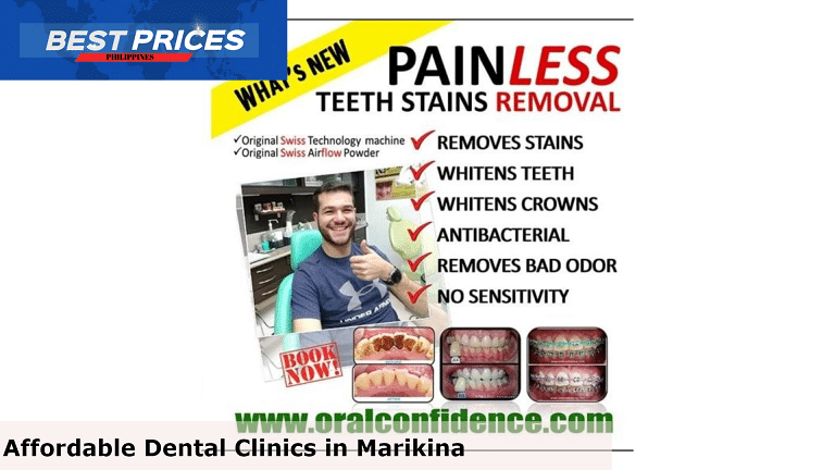 Oral Confidence - Affordable Dental Clinic Marikina, Affordable Dental Clinic Marikina, Best Dental Care Clinics Marikina City, Dentists in Marikina City Philippines, dental clinic in marikina open today, best dental clinic in marikina, dental clinic in marikina accredited by intellicare, dental clinic concepcion marikina, dental clinic near me, dental clinic ayala mall marikina, dental clinic near me with price, free dental services marikina, Emergency Dental Treatment, Which doctor is best for teeth?, How do I choose a dentist in Philippines?, How do I choose a dental practice?, dental clinic marikina bayan, dental clinic in marikina open today,